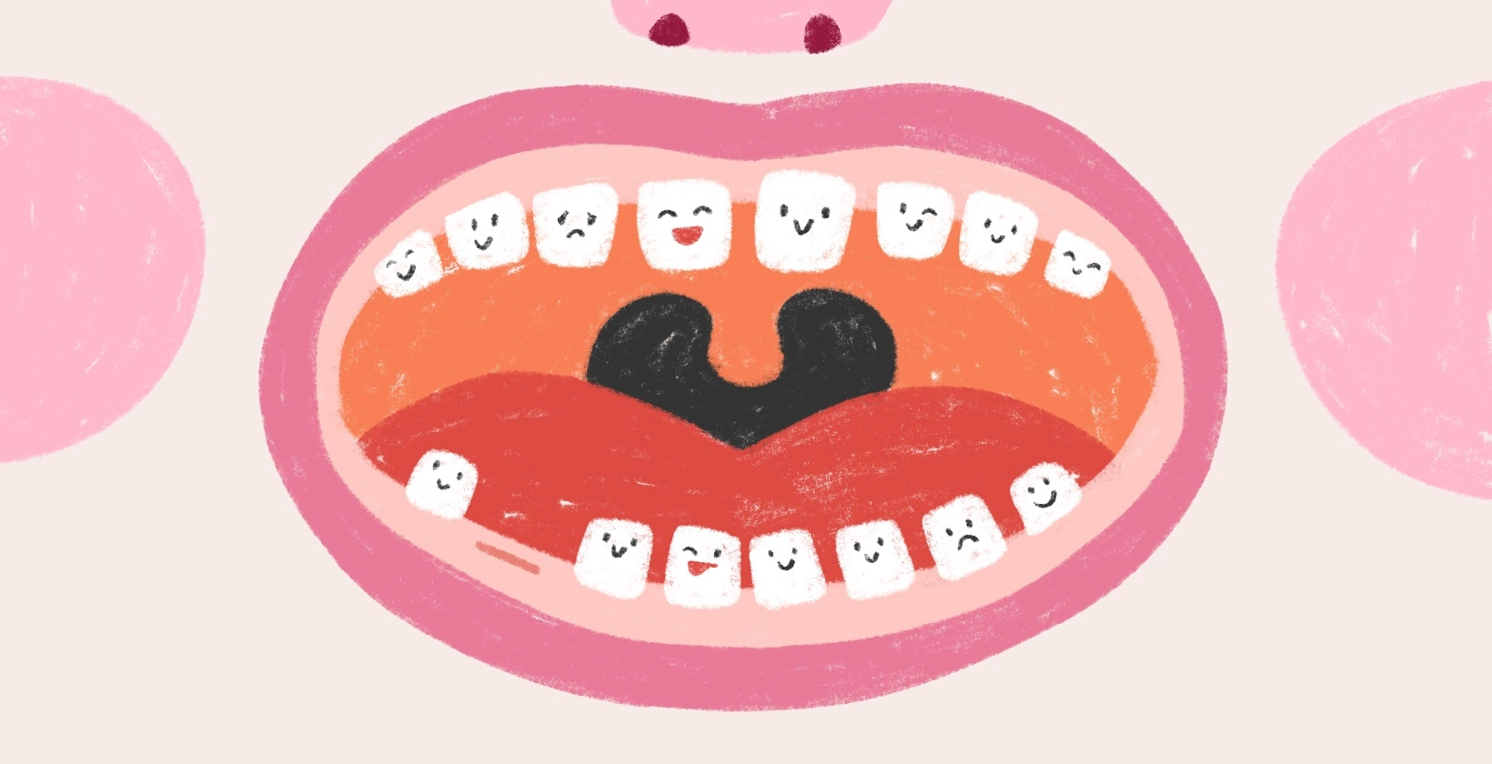 Кариес у детей: как предотвратить и вылечить